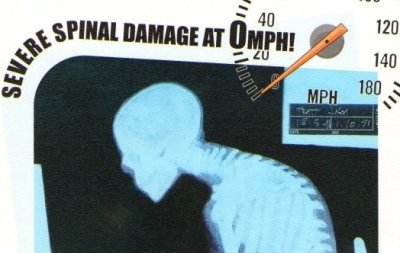 severe-spinal-damage